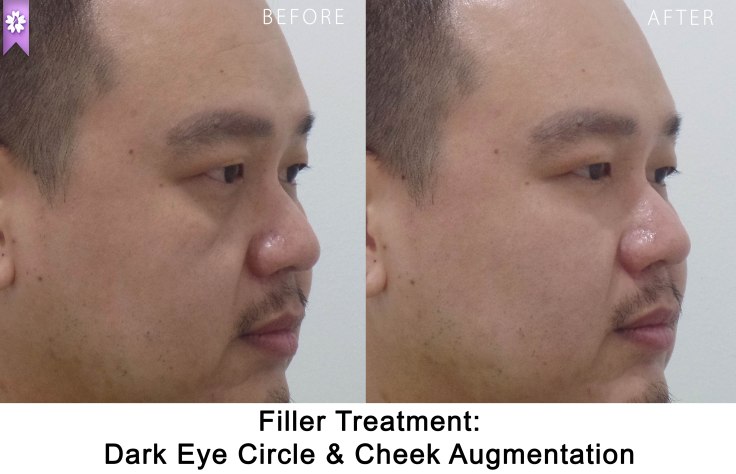 SAMSUNG CAMERA PICTURES