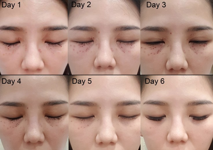 oil seed daily progress