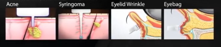 Agnes Treatment general